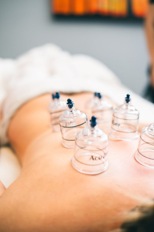 Cupping - My Store